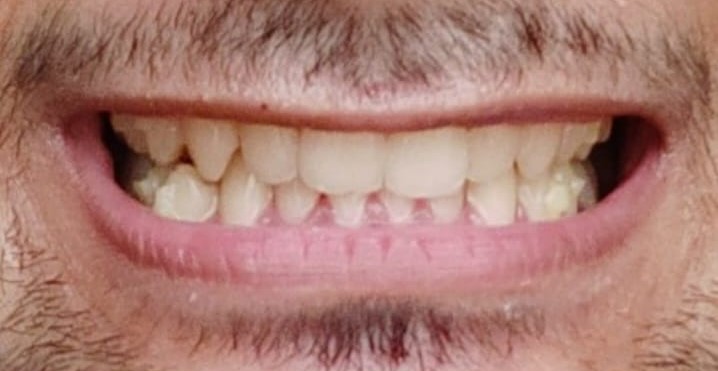 Before image