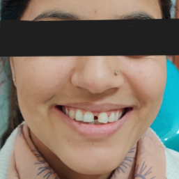 Before image