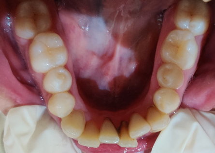 Before image